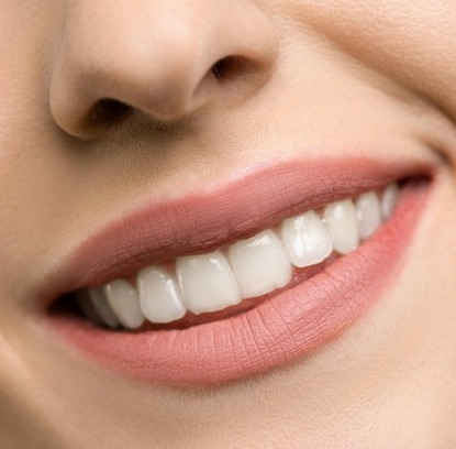 Cosmetically improved teeth