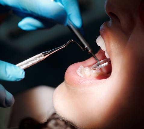pharmacist with teeth whitening products