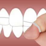 Flossing Teeth