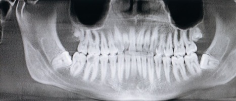 dentist x-ray dentist x-ray of patient