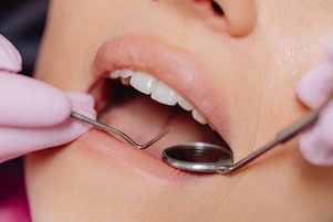 Alpine Dental Hygienist cleaning teeth
